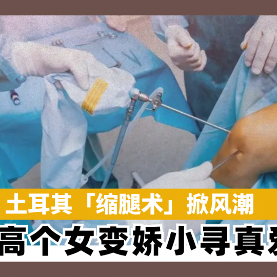 土耳其「缩腿术」掀风潮 高个女变娇小寻真爱