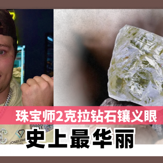 珠宝师2克拉钻石镶义眼  史上最华丽