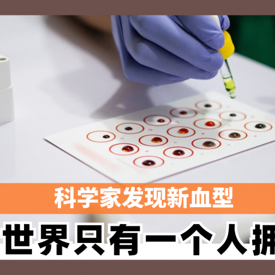 科学家发现新血型 全世界只有一个人拥有