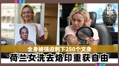 全身被强迫刺下250个文身 荷兰女子洗去烙印重获自由