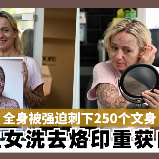 全身被强迫刺下250个文身 荷兰女子洗去烙印重获自由